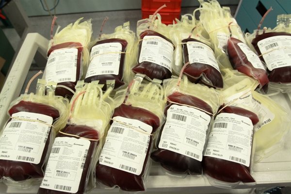 افزایش احتمال لختگی خون در گروه‌های خونی A و B