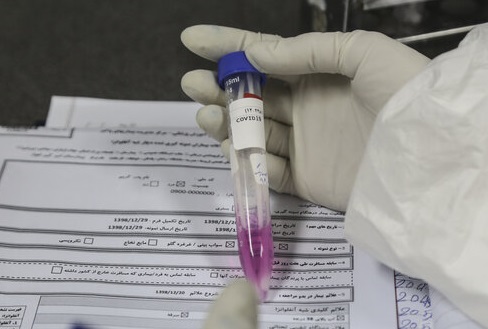 پیوستن ایران به کارآزمایی بالینی جهانی برای درمان کرونا 