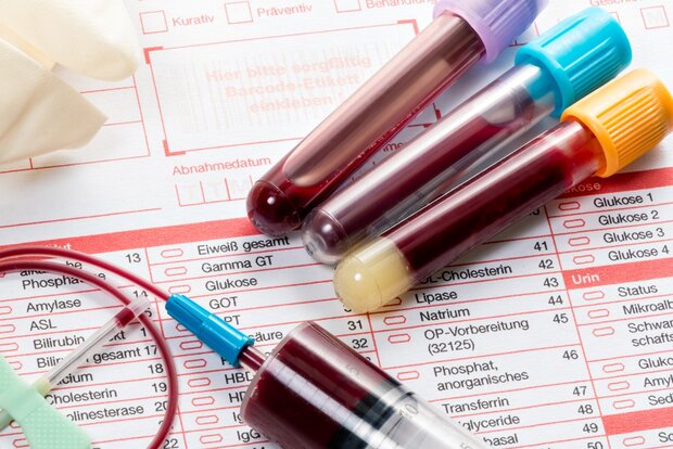 آزمایش خون ۵۰ نوع سرطان را شناسایی می‌کند