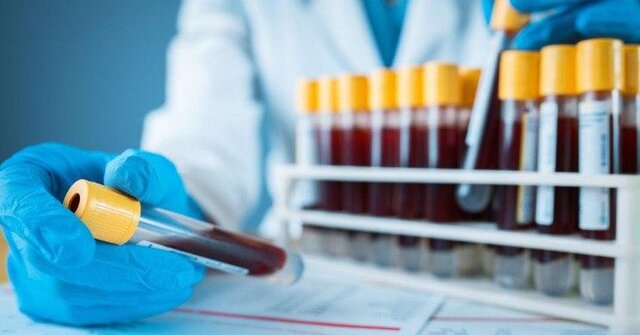  تجمیع پادتن‌های نجات یافتگان کرونا برای توسعه درمانی جدید