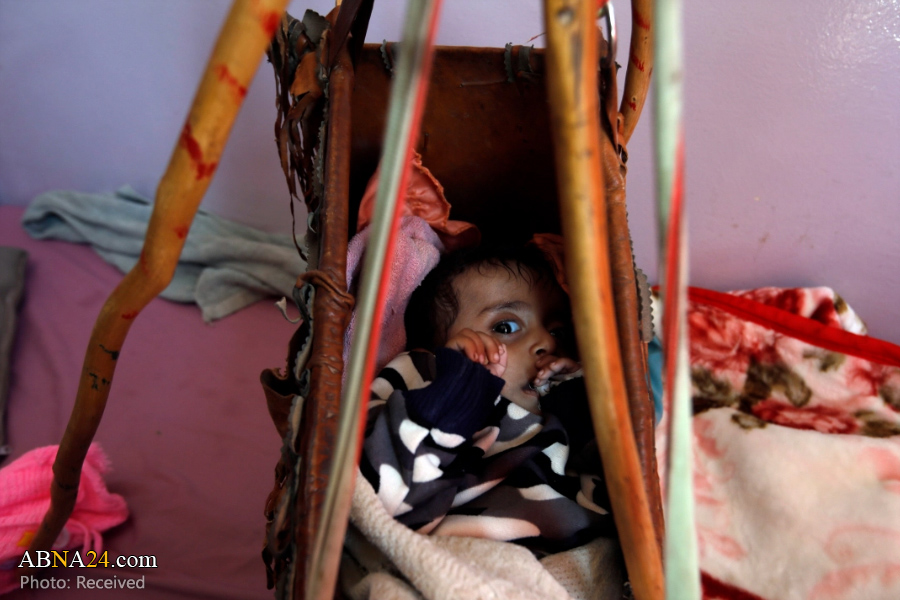 تصاویر دردناک از کودکان یمنی+عکس