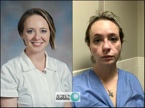 تصویر دردناک از پرستار قبل و بعد از کرونا+عکس