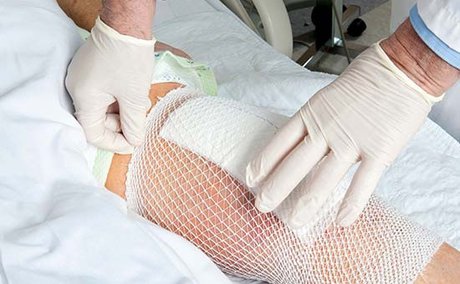 ساخت نانوفیبری برای ترمیم زخم با کمک روغن شترمرغ