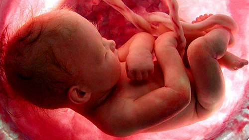 طرح جدید مجلس برای صدور اجازه سقط جنین