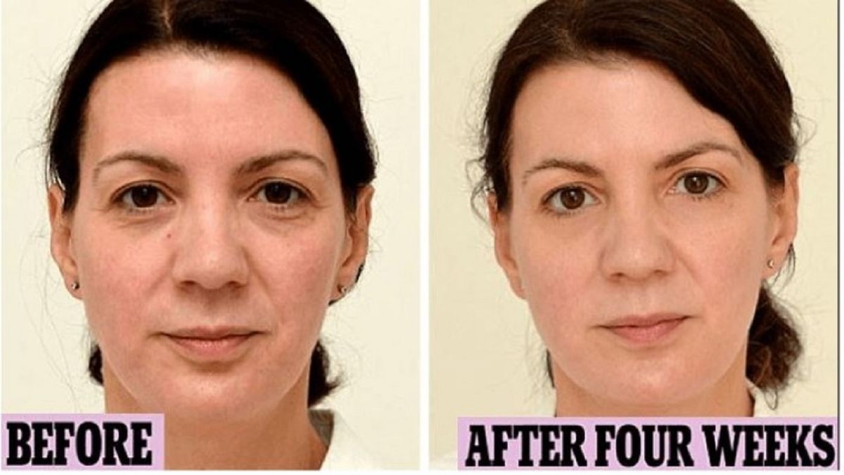 چهره یک زن پس از نوشیدن آب خالی به مدت یک ماه+عکس