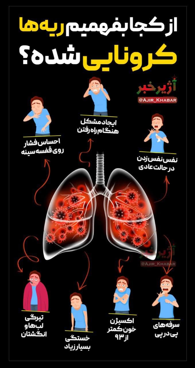این علائم یعنی حتما ریه هایتان کرونایی شده+عکس این علائم یعنی حتما ریه هایتان کرونایی شده+عکس