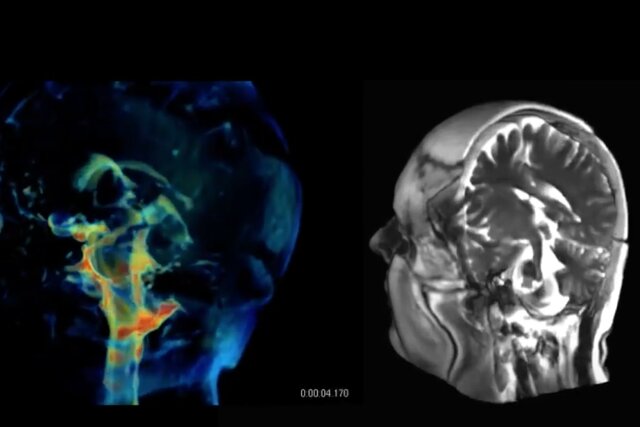 فناوری جدیدی برای تصویربرداری ۳ بعدی از مغز
