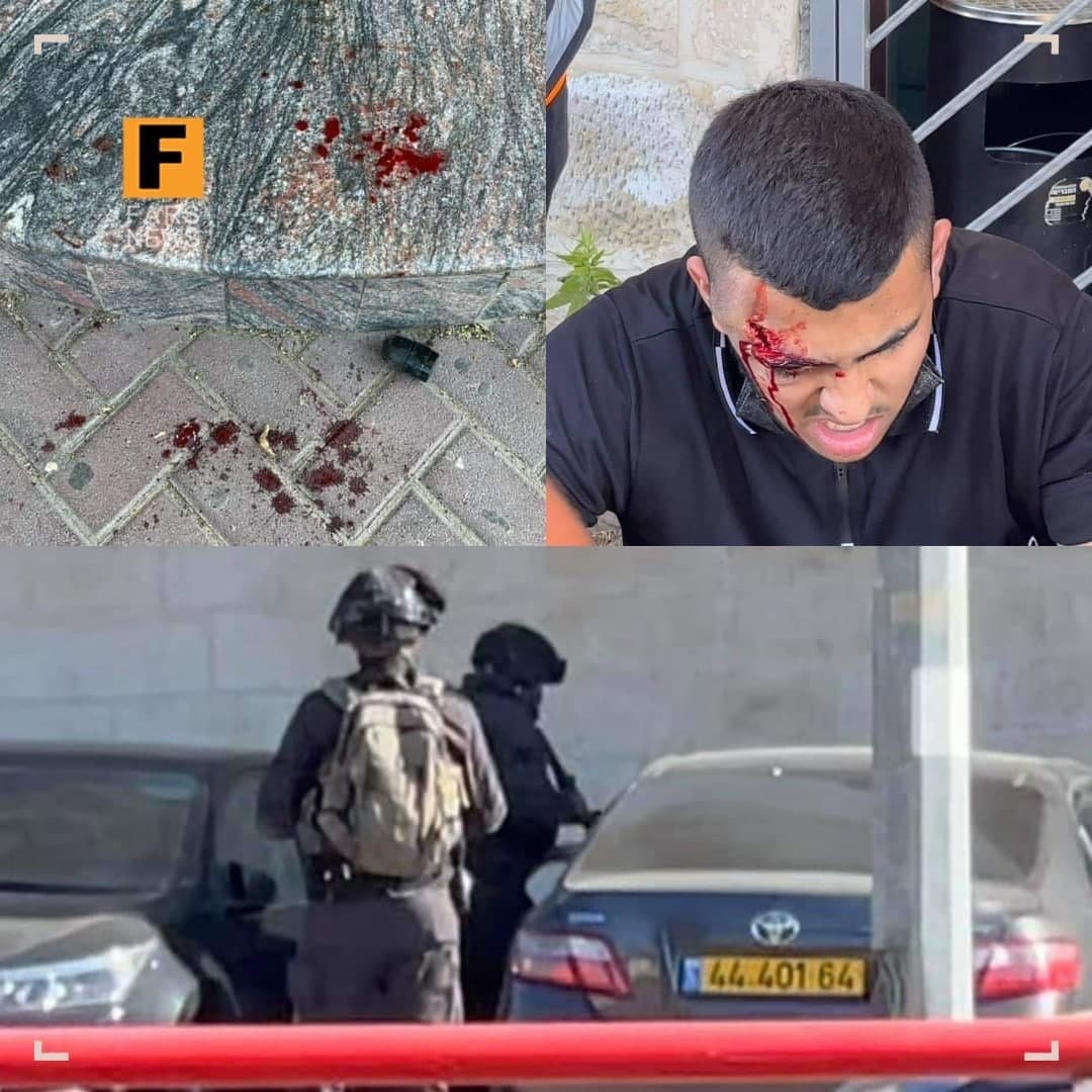 شلیک به سر جوان فلسطینی از فاصله صفر+عکس