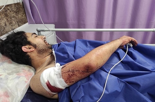 حمله زورگیران به عکاس تهرانی+عکس