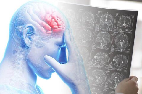 تومور مغزی چگونه بر کیفیت زندگی افراد تاثیر می‌گذارد؟